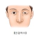 눈꺼풀 처침증 이미지