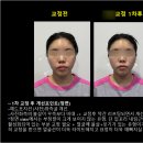 동원한의원 | 안면비대칭 두상교정 한의원 내돈내산 후기