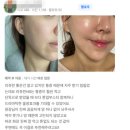 더윤피부과의원 | [공지] [ 마감임박 ] 더윤피부과 12/22~31일 한정 깜짝 이벤트 | 성수동 피부과전문의