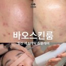 에스테틱 바오 | 좁쌀여드름 없애기 프로젝트! 일산피부관리 에스테틱 바오스킨룸 솔직후기