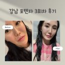 차중 | 모공이 조용히 작아지는 중.. 강남 포텐자 3회차 후기