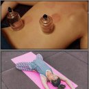 역곡정형외과의원 | 정형외과 환자, 여행 복귀를 위한 무릎과 팔꿈치 건강 관리법