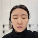 미모(MIMO) - 순천시 | 강남역 피부과 추천 여드름 흉터치료 MIMO 미모 레이저 솔직 후기
