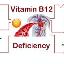 B12-1 이미지