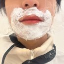 판교연세피부과의원 | 남자 수염 레이저 제모 판교 피부과 밴스의원 후기