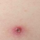 등산시 진짜 조심하세요. 이미지