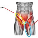 사타구니 통증 왜 나타나는지 함께 알아봅시다 이미지