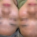 수야에스테틱
