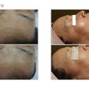 알라딘필링 이미지