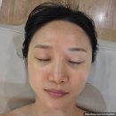 양산에스테틱 증산 라피에스타 더 웰 에스테틱 여드름케어 후기