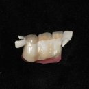 엘리트치과기공소 이미지