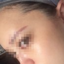 스킨누보세븐 이미지