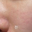 베니스킨