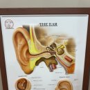 밝은소리보청기 이미지