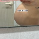 삼인요양병원 | 곧 있으면 진짜 엄마 (임신 28주~37주, 임신후기, 밑빠짐증상, 튼살, 임신선, 역아, 태아 딸꾹질)