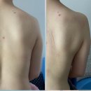 수원 출장마사지 바디핏테라피 후기입니다^^