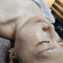 [다산동 피부관리]PHA물톡스 후기_아이퀸에스테틱 남양주점