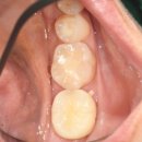 애플치과기공소 이미지