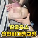 정안카이로프락틱 | 대구 수성구 턱관절 통증 , 마사지와 교정으로 가능 ! 바디솔루션 체형교정!
