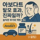 아보다트 탈모 효과, 진짜일까? 솔직한 후기와 팩트 체크 (+꿀팁)