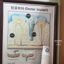 박성호치과 네이버블로그