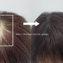 스칼프디자인센터 광주점 이미지