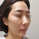 순백피부과 | 일산피부과 스킨보톡스