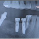 유앤아이아덴스치과의원 이미지