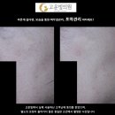 포마