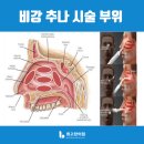 홈플러스 익스프레스지행점 | [공지] 비염축농증은 최고한의원 - 비강추나로 코막힘을 뻥!