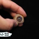 코리아의안센터 티스토리