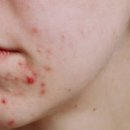 이소약국 이미지