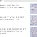 치아교정, 루시아치과 세라믹교정 이미지