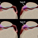 본큐어한의원 이미지