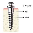 바른이치과교정과치과의원 | 강서구 방화동 치과 어린이 교정 추천 전치부 반대교합 주걱턱 성장조절 Facemask 교정치료