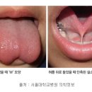 미즈맘 의원 네이버블로그