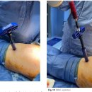 신의료기 이미지