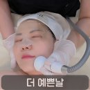더예쁜피부샵 - 강릉시 경강로2255번길 7 | 여름자외선에 지친 피부 진정관리, 봉명동 피부샵 더 예쁜날 아이스 윤광관리