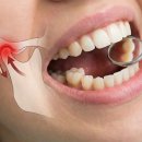 광교미소바른치과의원 | 광교 치과 추천 , 턱관절 통증 '이게' 원인일 수 있습니다