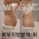 에코메디스킨케어