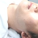 크로마제이 | 구미 비산동 피부샵 크로마제이 크로이오 더마 플래닝 후기