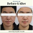 순수스킨케어 이미지