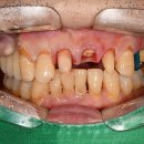 삼아치과기공소 이미지