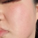 수학귀신 | [COHA체험단] rdrd 레드애플락토진정세럼 체험단 후기