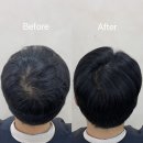 메움스칼프 | 남성 탈모 커버 전문💪 정수리 & 가르마 두피페인팅 시술 후기 | 아르투헤어 홍대본점