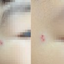 [단독] 3살 포크로 찌르고 박치기 ‘퍽’...인천 어린이집 학대 의혹 이미지