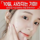 SNS 초핫 인기!! 10일만에 기미 뿌리까지 제거 ! 청귤 제로 스팟세럼 30ml 이미지