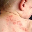 벨르스킨 이미지