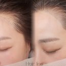 류헤어라인 - 북구 | 류헤어라인