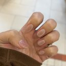 피버네일(fever nail)